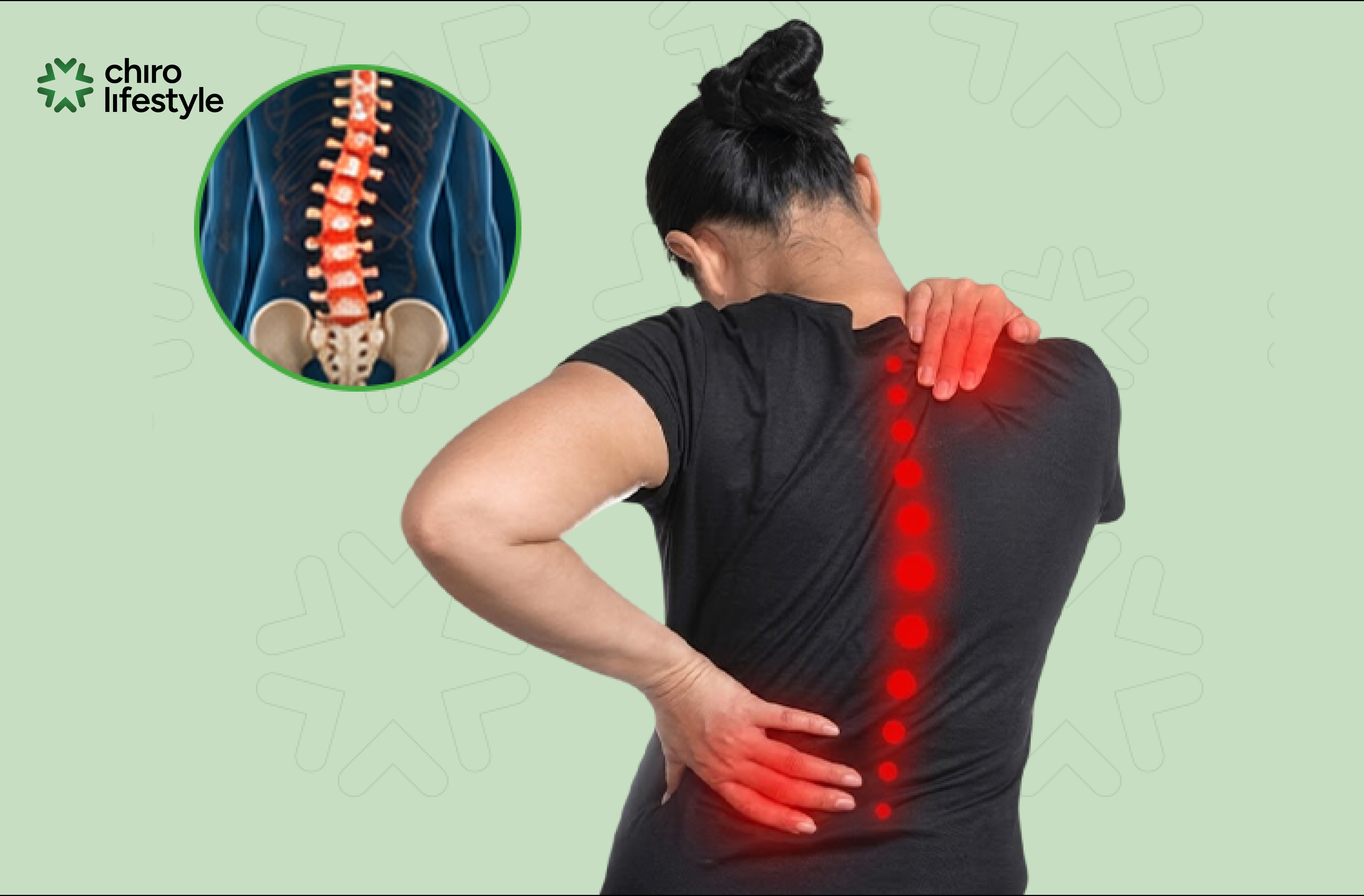 Cong vẹo cột sống là tình trạng cột sống bị cong bất thường.