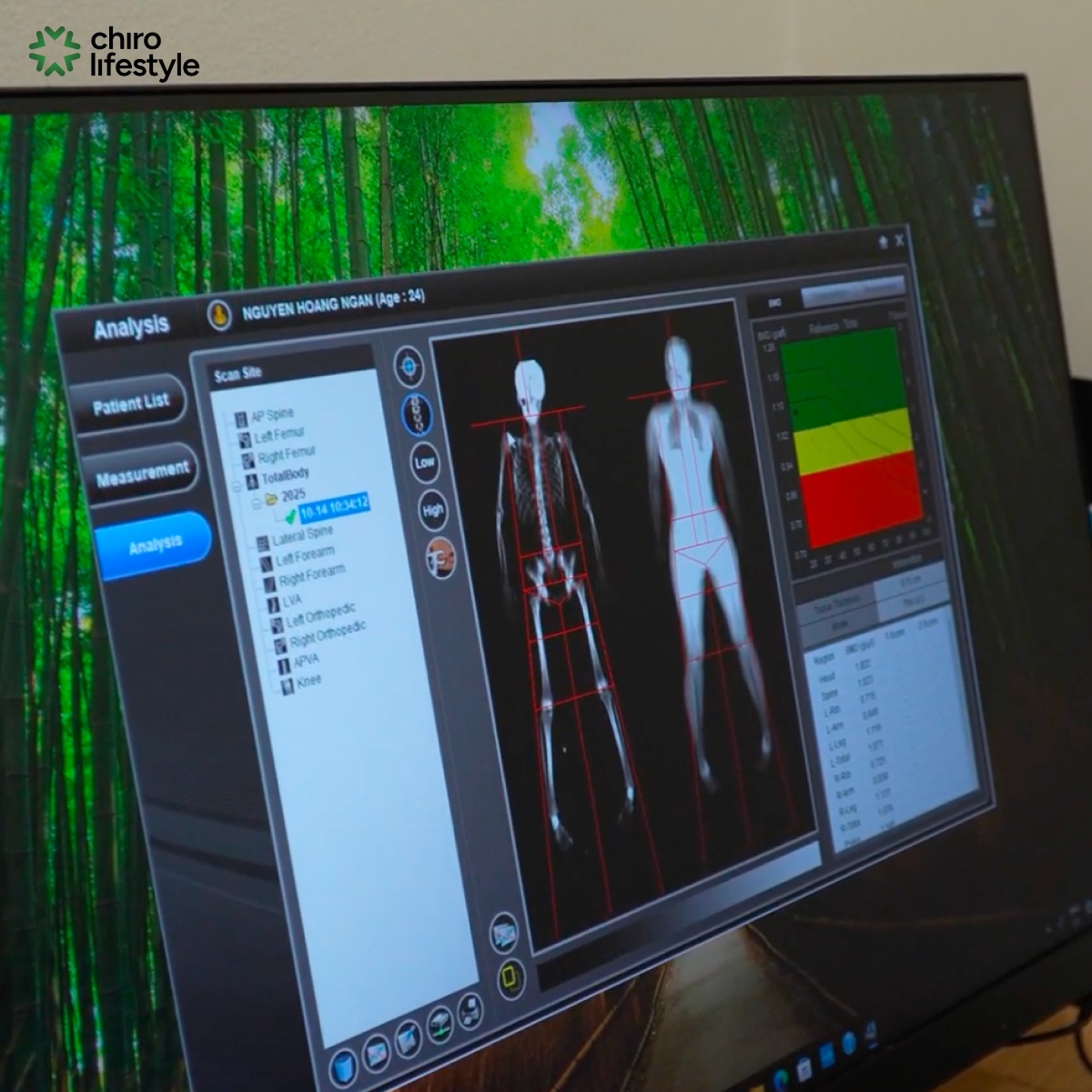 DEXA Scan results provide the scientific basis for doctors to personalize the applied force.