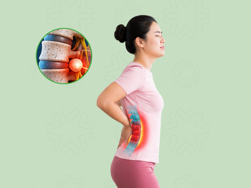 Herniated Disc