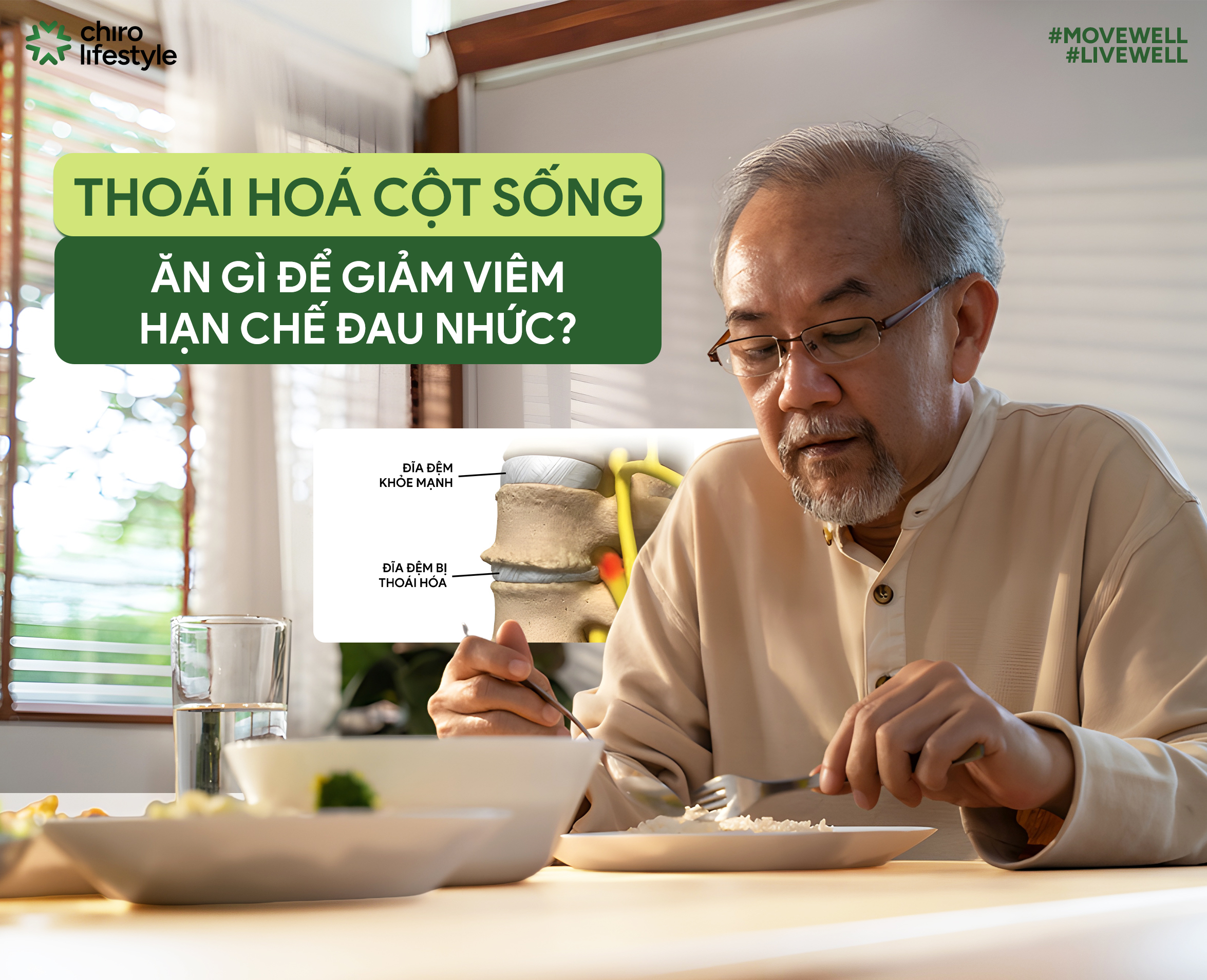 THOÁI HÓA CỘT SỐNG NÊN ĂN GÌ ĐỂ GIẢM VIÊM, HẠN CHẾ ĐAU NHỨC HIỆU QUẢ?