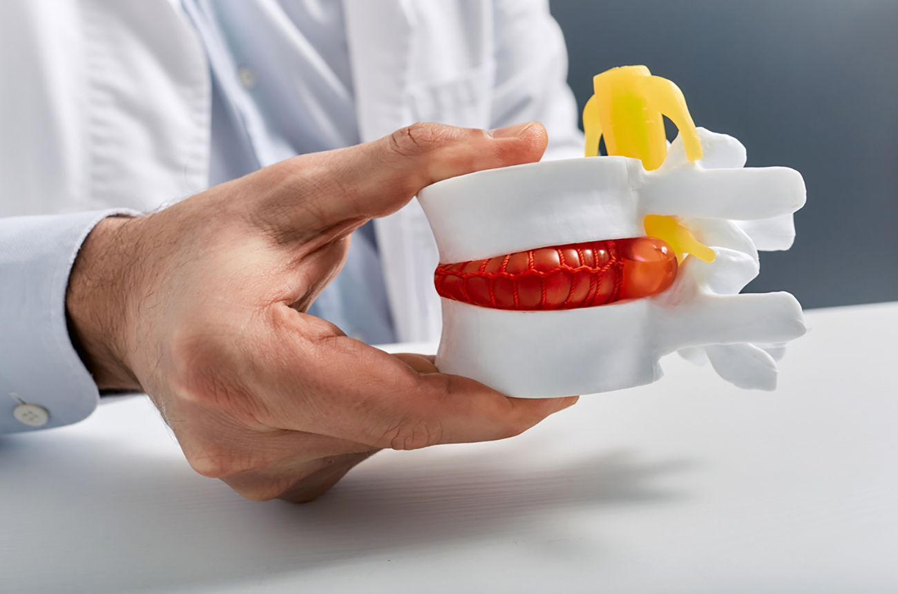 Lời khuyên chuyên gia để thúc đẩy quá trình hồi phục Thoái hóa Đĩa đệm