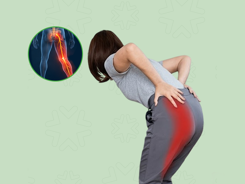 Sciatica