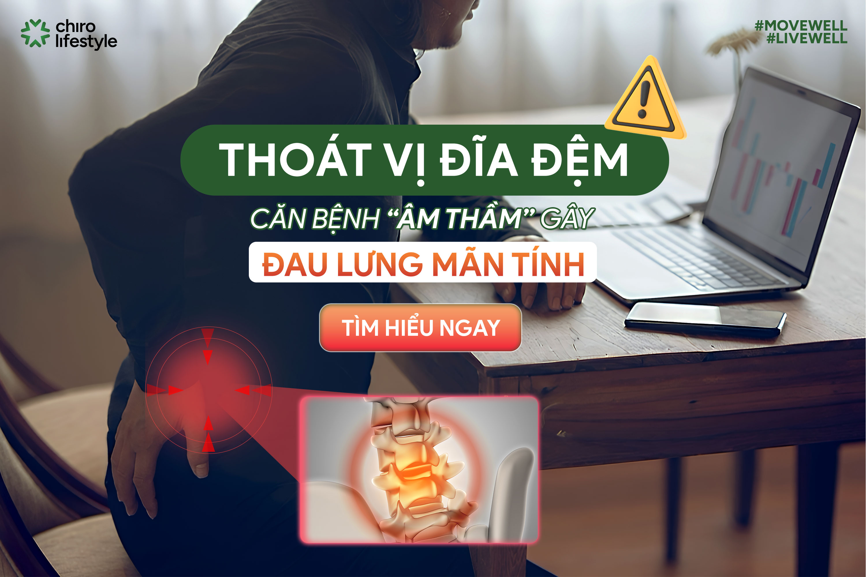 THOÁT VỊ ĐĨA ĐỆM LÀ GÌ? KHÁM PHÁ CĂN BỆNH “ÂM THẦM” GÂY ĐAU LƯNG MÃN TÍNH