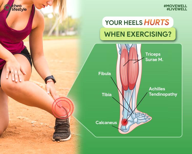 HEEL PAIN – ACHILLES' TENDONITIS: CAUSES, SYMPTOMS, AND EFFECTIVE TREATMENT SOLUTIONS AT CHIRO LIFESTYLE MEDICINE