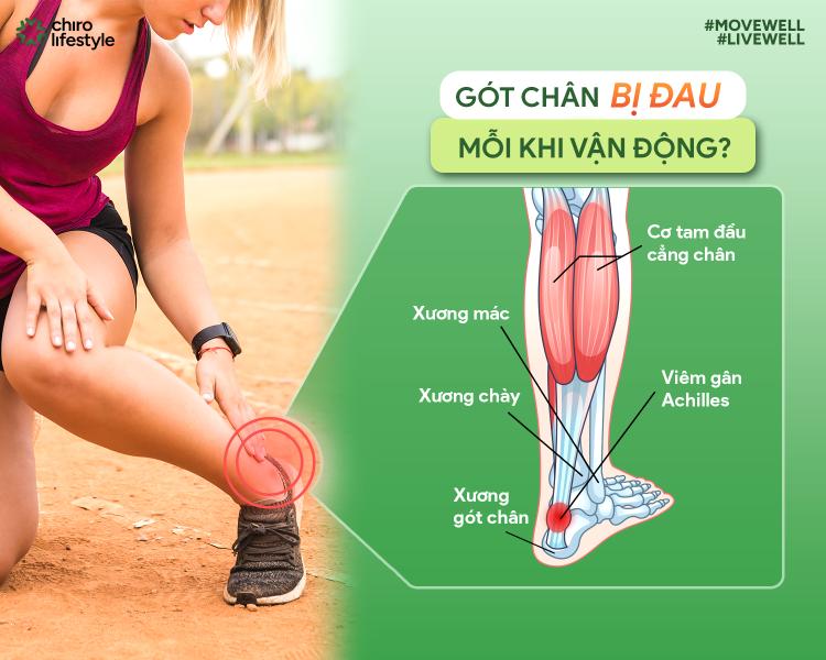 ĐAU GÓT CHÂN – VIÊM GÂN ACHILLES: NGUYÊN NHÂN, DẤU HIỆU VÀ GIẢI PHÁP ĐIỀU TRỊ HIỆU QUẢ TẠI CHIRO LIFESTYLE MEDICINE